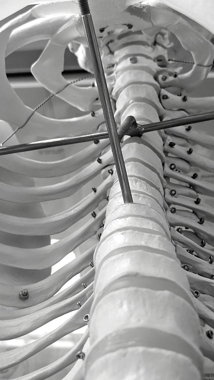 services-05 Intricate black and white photo of a human rib cage model with metal rods and wires